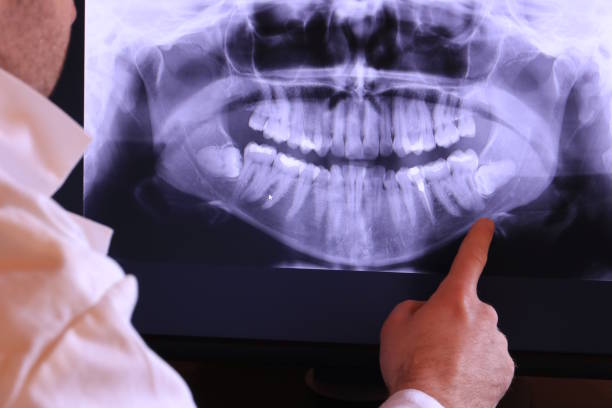 Best Emergency Tooth Extraction in Kings Park, VA