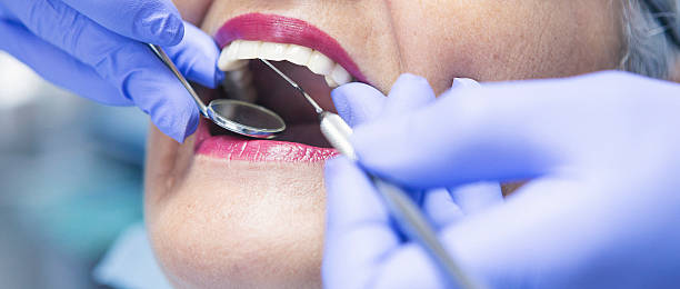 Best Urgent Care for Lost Fillings or Crowns in Kings Park, VA